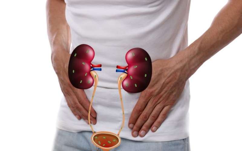 Radang Saluran Kemih